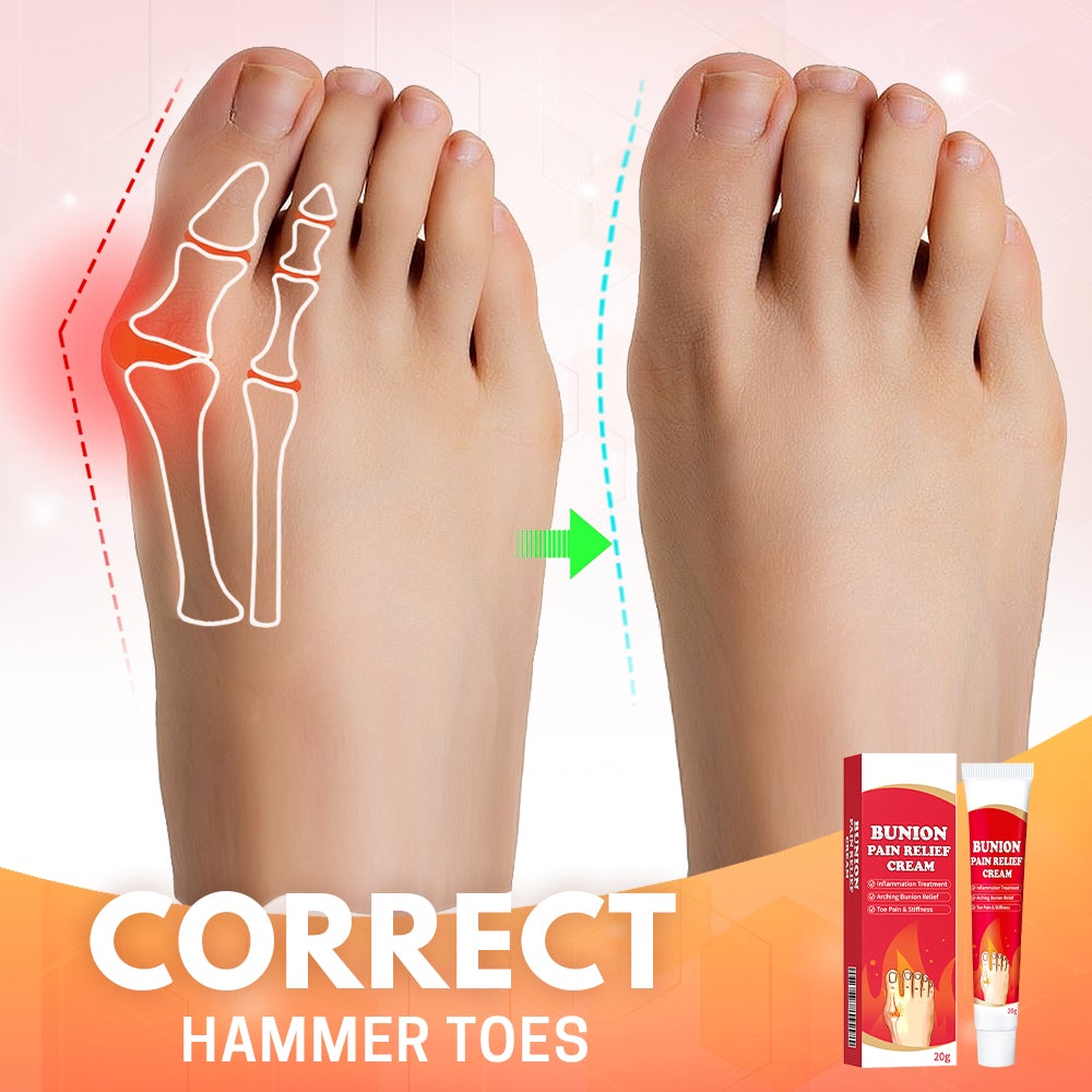 Bunion Toe Relief Cream